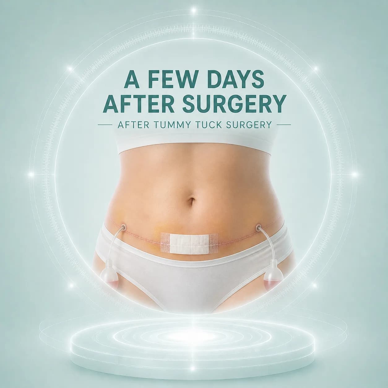 The First Few Days After Tummy Tuck Surgery