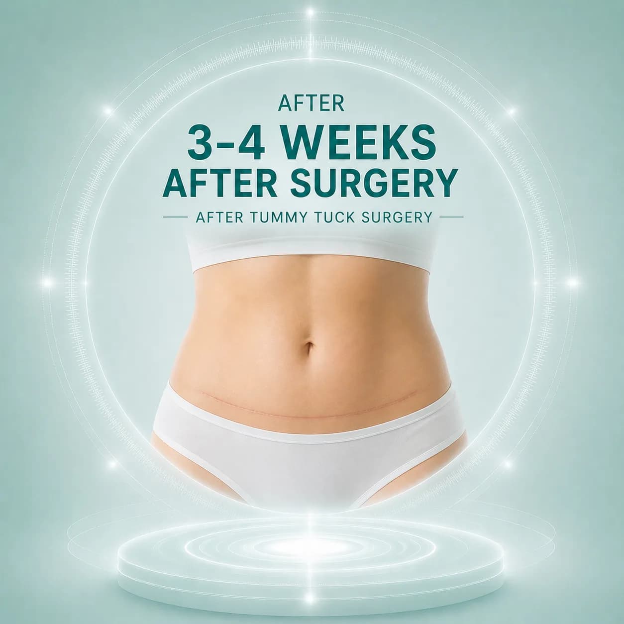 Weeks 3–4 After Tummy Tuck Surgery