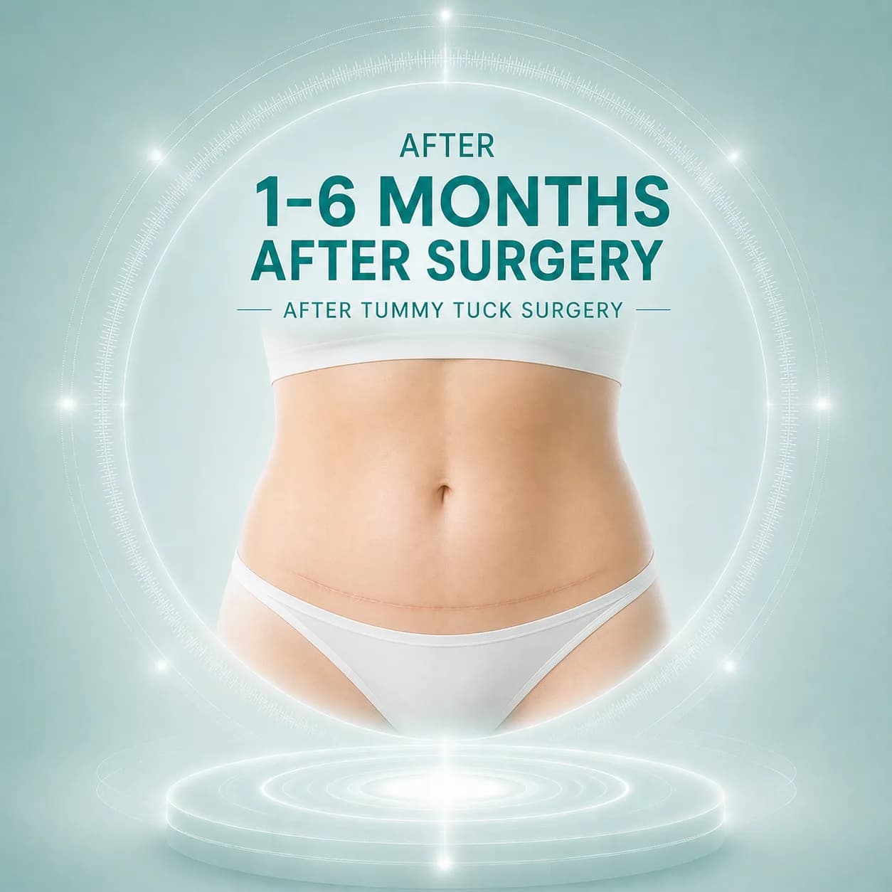 Months 1–6 After Tummy Tuck Surgery